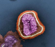インフルエンザウイルスの電子顕微鏡写真（米疾病対策センター提供）