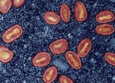 感染細胞内のエムポックスウイルス（赤く着色）の電子顕微鏡写真（米国立アレルギー感染症研究所提供・共同）