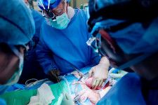 患者の腹部に移植したブタの腎臓を持ち上げ、機能を確かめる医師ら＝12日、ニューヨーク（ニューヨーク大提供・共同）