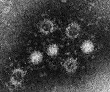 E型肝炎ウイルスの電子顕微鏡写真（国立感染症研究所提供）