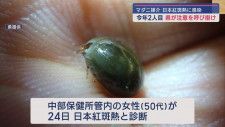マダニが媒介する感染症「日本紅斑熱」　静岡県内2人目の患者を確認　50代女性　発熱や頭痛の症状も快方に向かう　