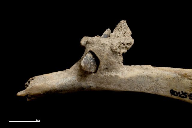 4000年前の暴力物語る決定的証拠、矢じりが刺さった肋骨を発見