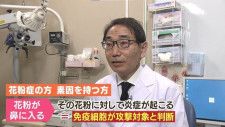 北海道でも悩む人が急増の「花粉症」。その特徴と対策とは？アレルギー性鼻炎の専門家である北海道大学病院アレルギーセンター長にインタビュー