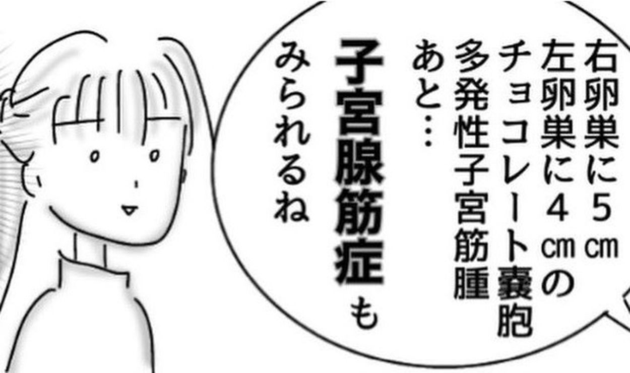 突然の腹痛！検査結果は、チョコレート嚢胞と多発性子宮筋腫に子宮腺筋症のフルコース!?さらに手術はなんと4カ月待ち！【作者に聞く】(Walkerplus)  - goo ニュース