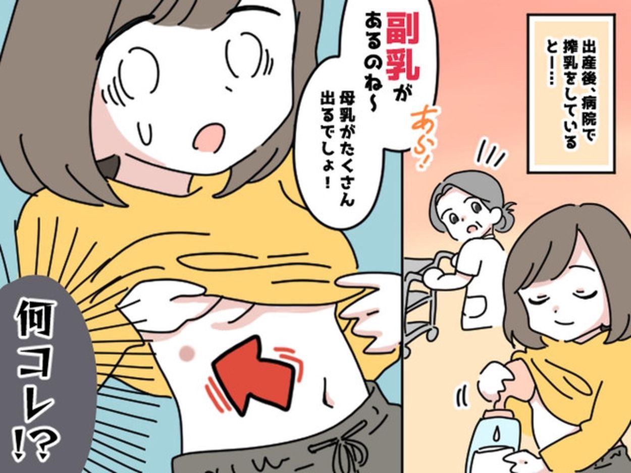 副乳 えっ、乳首が8つ！？ 30年間ずっと気が付かなかった『私の体に隠れていたもの』の正体とは？(ftn-fashion trend news-) -  goo ニュース